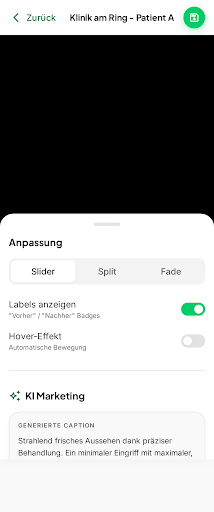 vnPro mobiler Vorher-Nachher-Editor